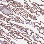Anti-CTDSPL Antibody