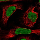 Immunofluorescent staining of human cell line U-2 OS shows localization to nucleoplasm & nuclear membrane.