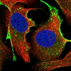 Immunofluorescent staining of human cell line U-2 OS shows localization to vesicles.