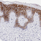 Immunohistochemical staining of human skin shows strong membranous positivity in squamous epithelial cells.