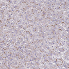 Immunohistochemical staining of human liver shows moderate membranous positivity in hepatocytes.
