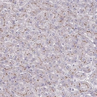 Immunohistochemical staining of human liver shows moderate membranous positivity in hepatocytes.