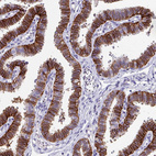 Immunohistochemical staining of human fallopian tube shows moderate to strong membranous positivity in glandular cells.