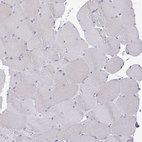 Immunohistochemical staining of human skeletal muscle shows no positivity in myocytes as expected.