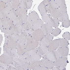 Anti-CLDN1 Antibody