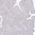 Immunohistochemical staining of human skeletal muscle shows no positivity in myocytes as expected.