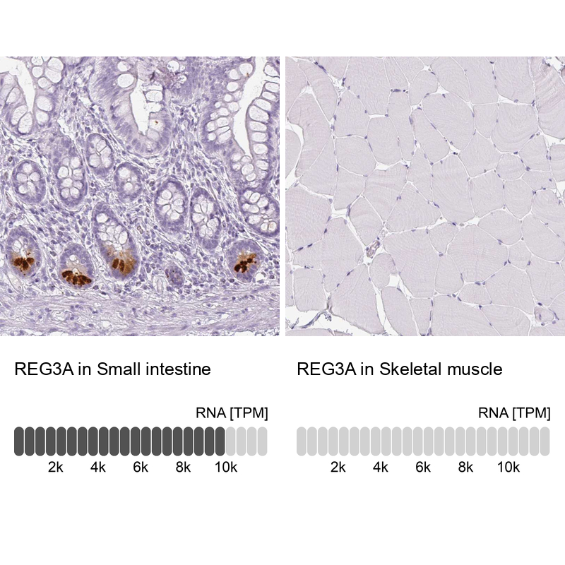 Anti-REG3A Antibody
