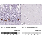 Anti-REG3A Antibody