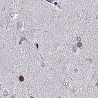 Anti-SOX21 Antibody