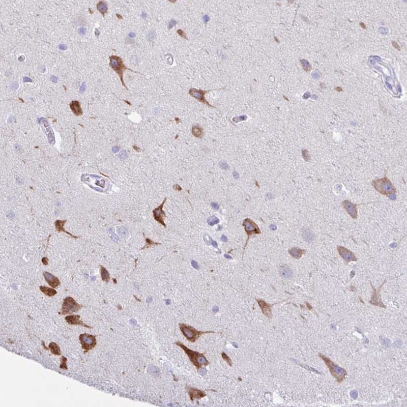 Anti-AGO3 Antibody
