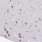 Anti-AGO3 Antibody