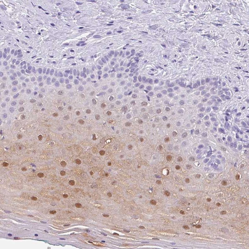 Anti-SERPINB4 Antibody