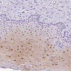 Anti-SERPINB4 Antibody