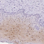 Anti-SERPINB4 Antibody
