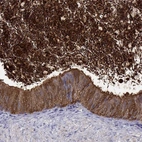 Immunohistochemical staining of human epididymis shows high expression.