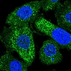 Immunofluorescent staining of human cell line PC-3 shows localization to vesicles.