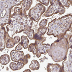 Anti-EDEM2 Antibody