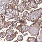 Anti-EDEM2 Antibody