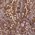 Immunohistochemical staining of human small intestine shows strong cytoplasmic positivity in lymphoid and glandular cells.