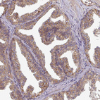 Immunohistochemical staining of human prostate shows moderate granular cytoplasmic positivity in glandular cells.