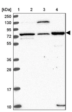 Lane 1: Marker [kDa] 250, 130, 95, 72, 55, 36, 28, 17, 10_br/_Lane 2: Human cell line RT-4_br/_Lane 3: Human cell line U-251 MG_br/_Lane 4: Human plasma
