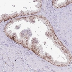 Immunohistochemical staining of human prostate shows moderate nuclear positivity in glandular cells.