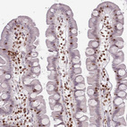 Immunohistochemical staining of human small intestine shows strong nuclear positivity in lymphoid cells.