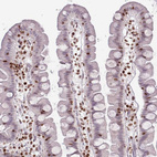 Anti-SELENOH Antibody