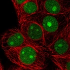 Immunofluorescent staining of human cell line MCF7 shows localization to nucleus & nucleoli.