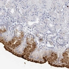 Anti-RAB33B Antibody