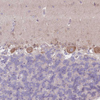 Immunohistochemical staining of human cerebellum shows moderate membranous positivity in Purkinje cells.