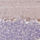 Immunohistochemical staining of human cerebellum shows moderate membranous positivity in Purkinje cells.