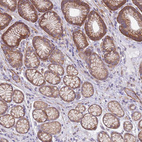 Immunohistochemical staining of human stomach shows moderate membranous positivity in glandular cells.
