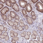 Immunohistochemical staining of human stomach shows moderate membranous positivity in glandular cells.