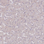 Anti-SLC26A6 Antibody