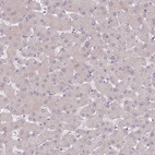 Immunohistochemical staining of human liver shows no positivity in hepatocytes as expected.