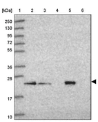 Lane 1: Marker [kDa] 250, 130, 95, 72, 55, 36, 28, 17, 10_br/_Lane 2: Human cell line RT-4_br/_Lane 3: Human cell line U-251MG sp_br/_Lane 4: Human plasma (IgG/HSA depleted)_br/_Lane 5: Human liver tissue_br/_Lane 6: Human tonsil tissue