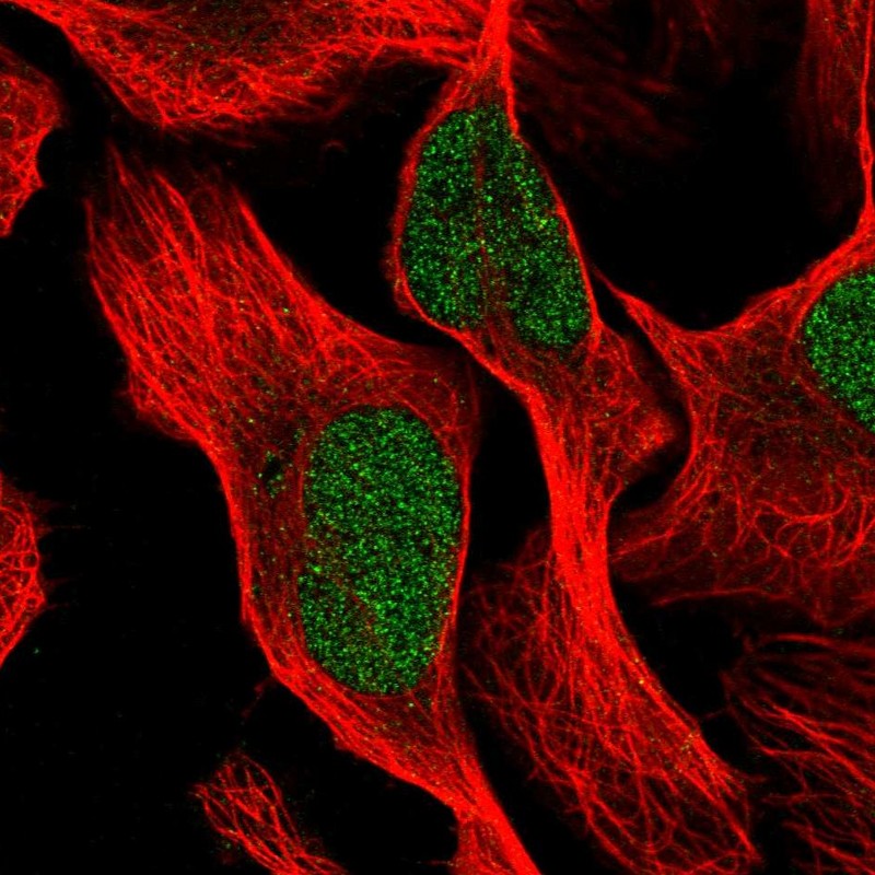 Anti-PTBP3 Antibody