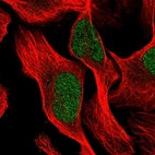Anti-PTBP3 Antibody