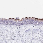 Anti-CPXM2 Antibody