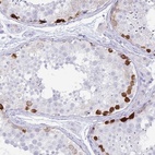 Immunohistochemical staining of human testis shows high expression.