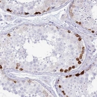 Immunohistochemical staining of human testis shows high expression.