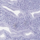 Immunohistochemical staining of human endometrium shows low expression as expected.
