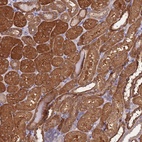 Anti-PRR32 Antibody