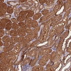 Anti-PRR32 Antibody