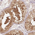 Anti-HERC2 Antibody