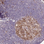 Immunohistochemical staining of human lymph node shows moderate cytoplasmic positivity in germinal center cells.