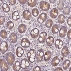 Immunohistochemical staining of human duodenum shows moderate cytoplasmic positivity in glandular cells.