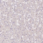 Immunohistochemical staining of human liver shows no cytoplasmic positivity in hepatocytes as expected.