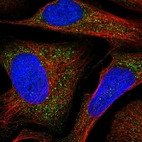 Immunofluorescent staining of human cell line U-2 OS shows localization to vesicles.